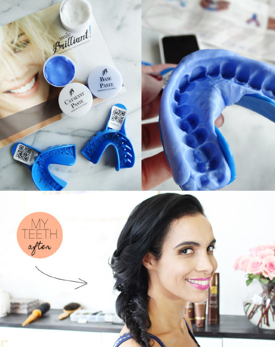 Get Wedding-Ready Teeth: Affordable & Convenient Whitening with Smile Brilliant